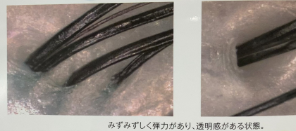 あなたの頭皮は大丈夫？