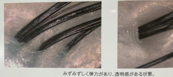 あなたの頭皮は大丈夫？